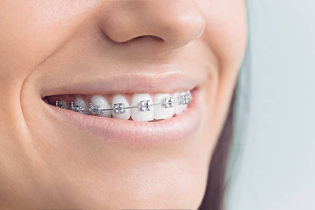Best Wisdom Tooth Removal  in Owens Cross Roads, AL